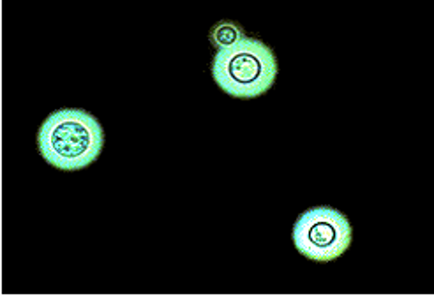 <p>you find these yeast cells on a smear from the nasal discharge of a cat, what might be the cause</p>