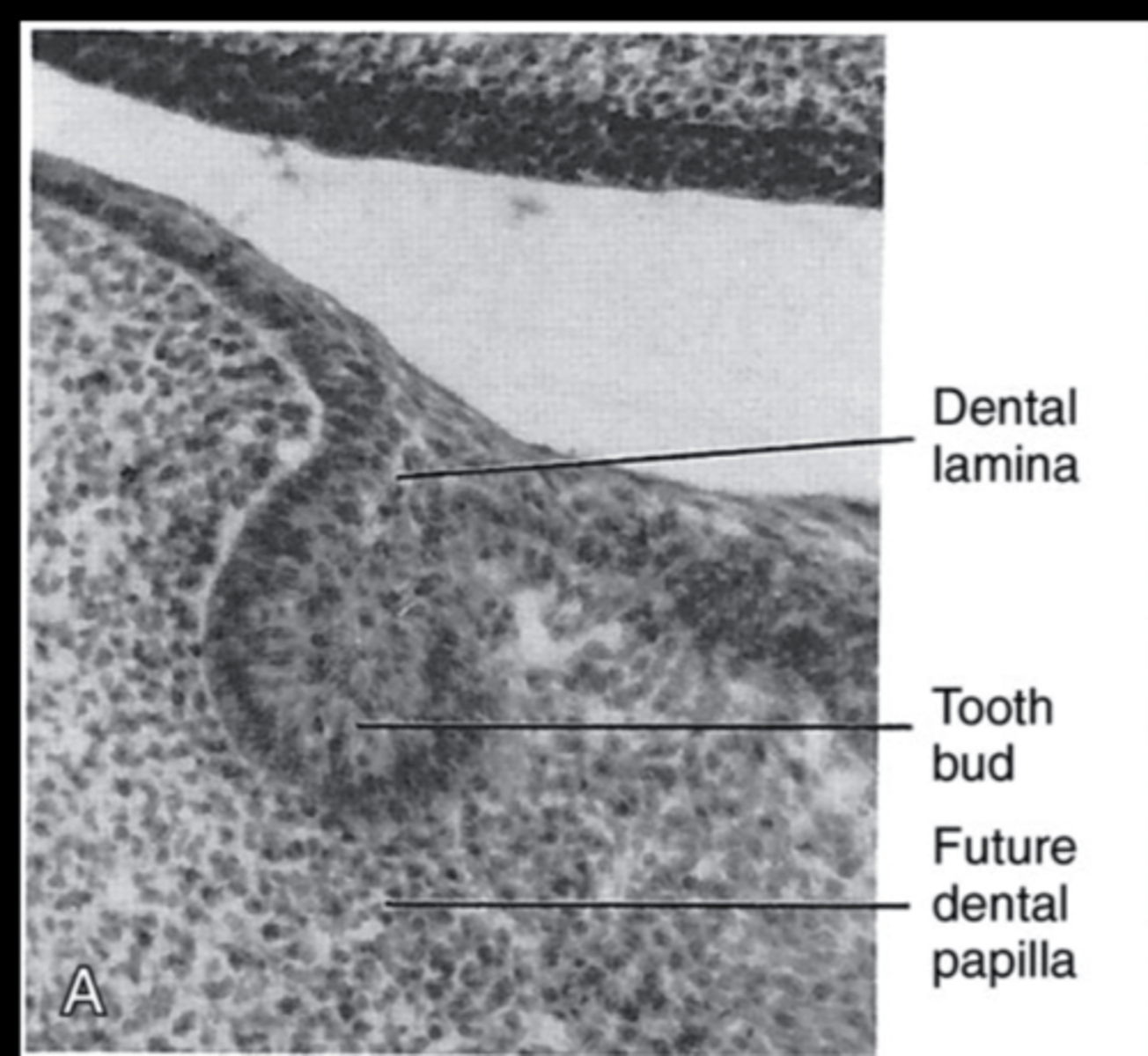 <p>First stage in development of enamal organ, initial budding of dental lamina in 20 areas</p>