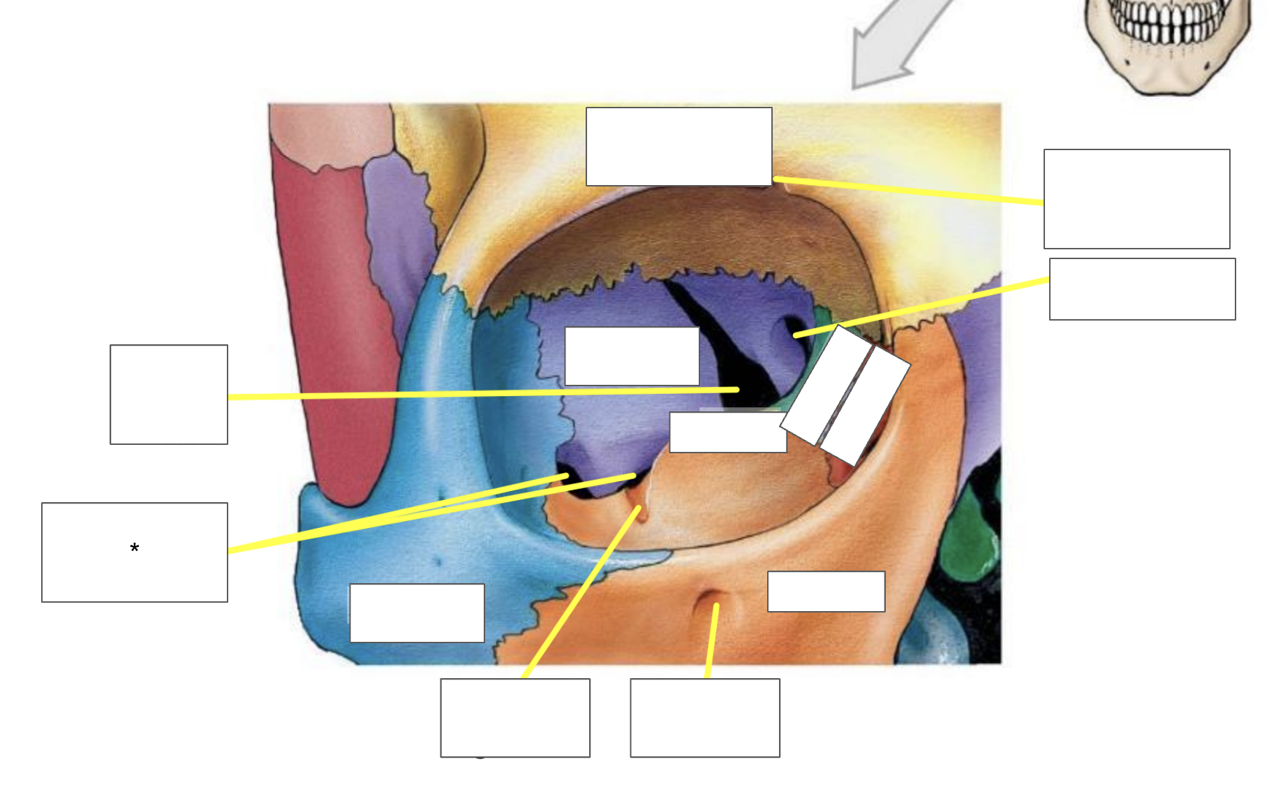 term image