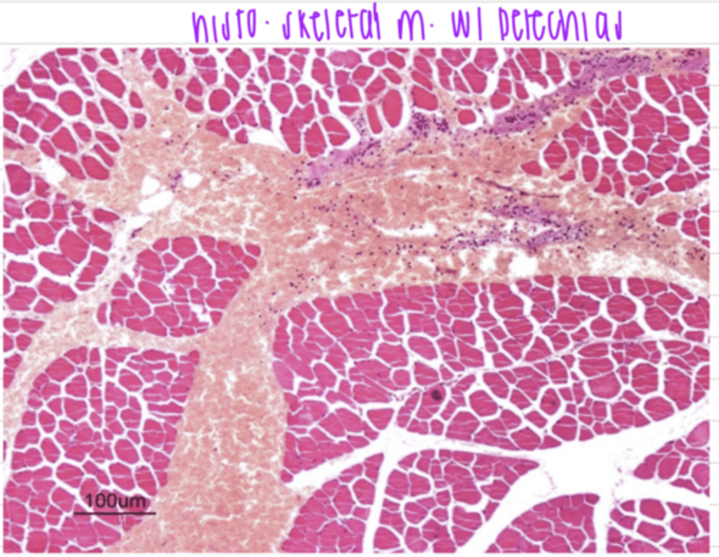 <p>RBCs outside of the vessels</p>