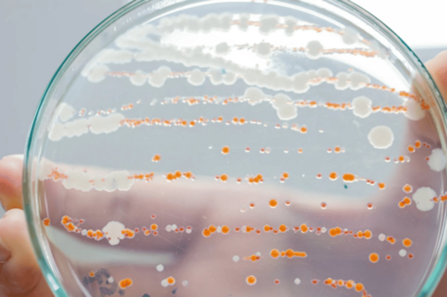 <p>Dark green colonies.</p>