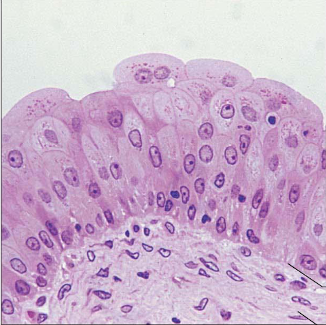 term image