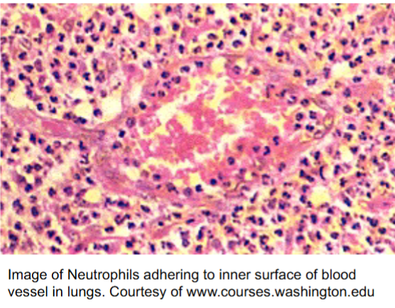 <p>Result of inflammation</p>