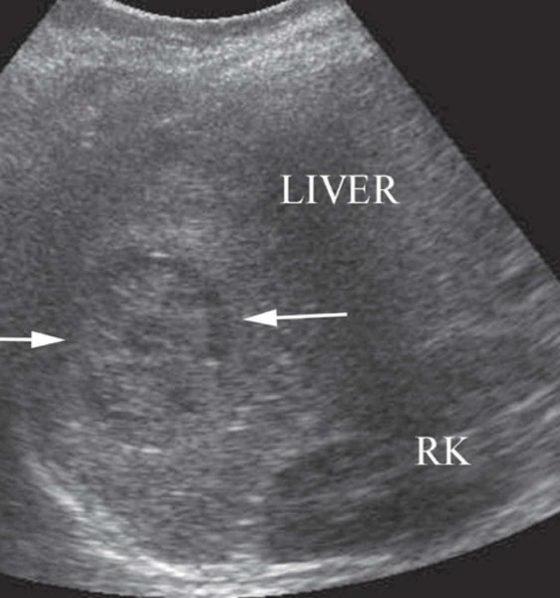 <p>What does this image show</p>