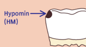 <p>It is a mineral deficit</p>