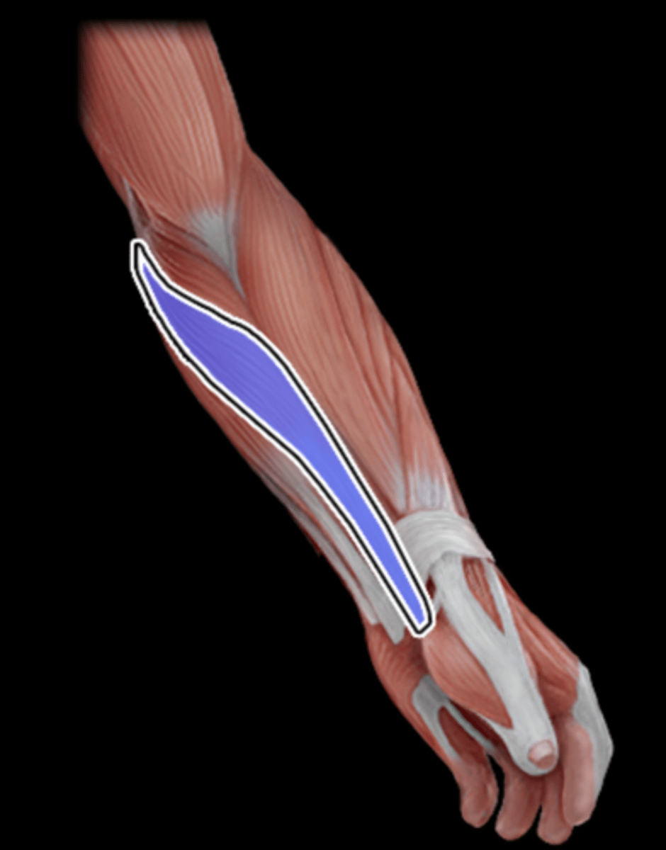 <p>What Muscle Is Highlighted?</p>