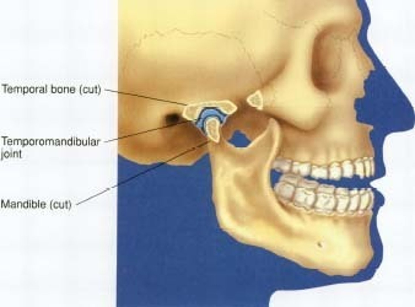<p>A joint between the mandibular condyle and the glenoid fossa.</p>