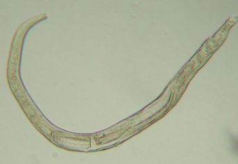 <p>larvae detected in gastric juice or vomitus after centrifugation</p><p>find larvae or worms in histologic sections&nbsp;</p><p>CANNOT see on endoscopy (0.7mm -1.0mm in length)</p>