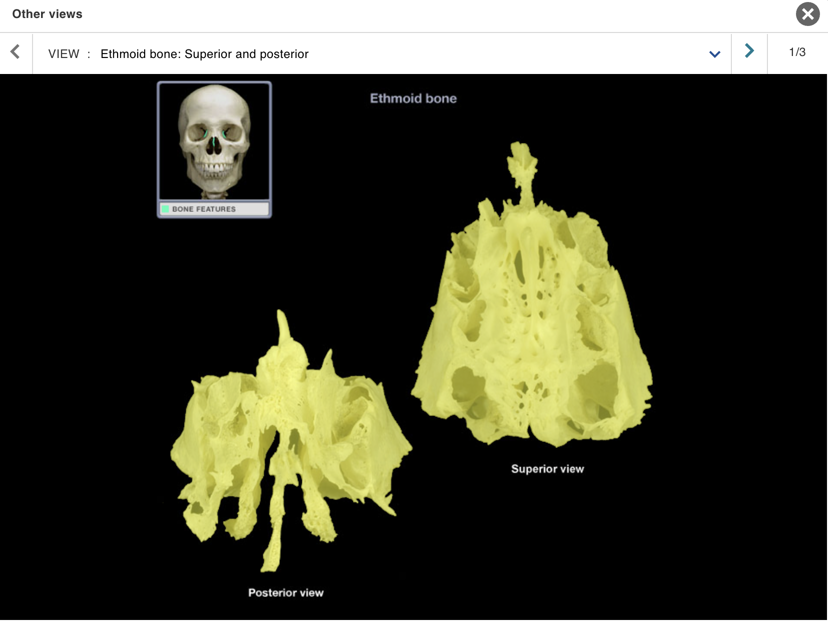 <p>Location:</p><p class="p1">• Nasal cavity</p><p class="p1">Description:</p><ul><li><p>﻿﻿Irregular-shaped bone</p></li><li><p>﻿﻿Characteristic features include cribriform plate, crista galli, and perpendicular plate</p></li></ul><p class="p1">Comment:</p><ul><li><p>﻿﻿Contributes to anterior cranial fossa, nasal cavity, and orbit</p></li><li><p>﻿﻿Contains numerous sinuses (air cells)</p></li></ul><p></p>