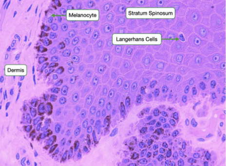 <p>“Spiny layer”</p><ul><li><p>Thicker (8-10 layers)</p></li><li><p>Keratinocytes begin dying</p></li><li><p>Desmosome connections: keratinocytes shrink during fixation</p></li><li><p>Langerhans cells</p></li></ul>
