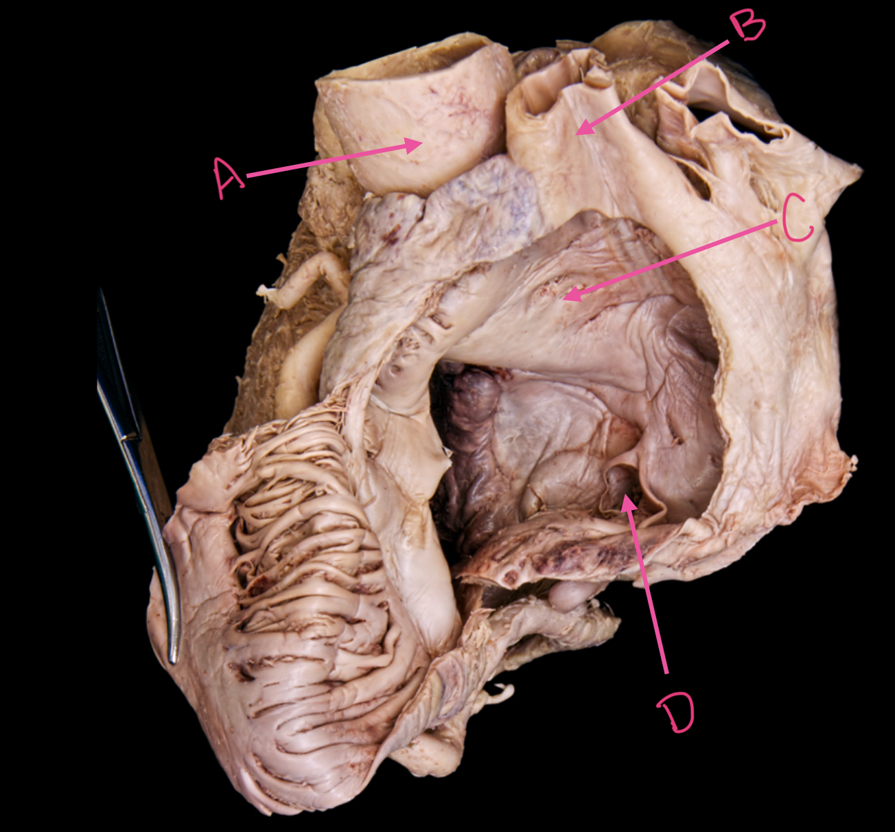 term image