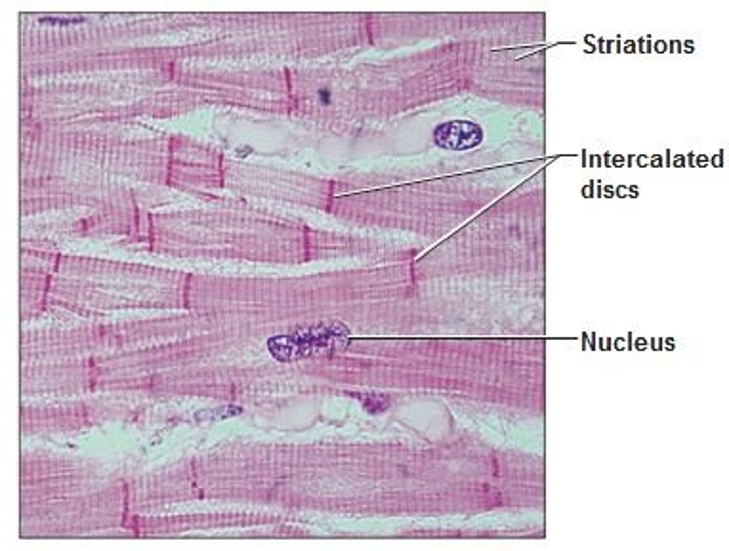<p>found only in the heart and consists of branching fibers that are connected to each other with intercalated discs. This involuntary muscle has a single nucleus in each cell but appears striated</p>