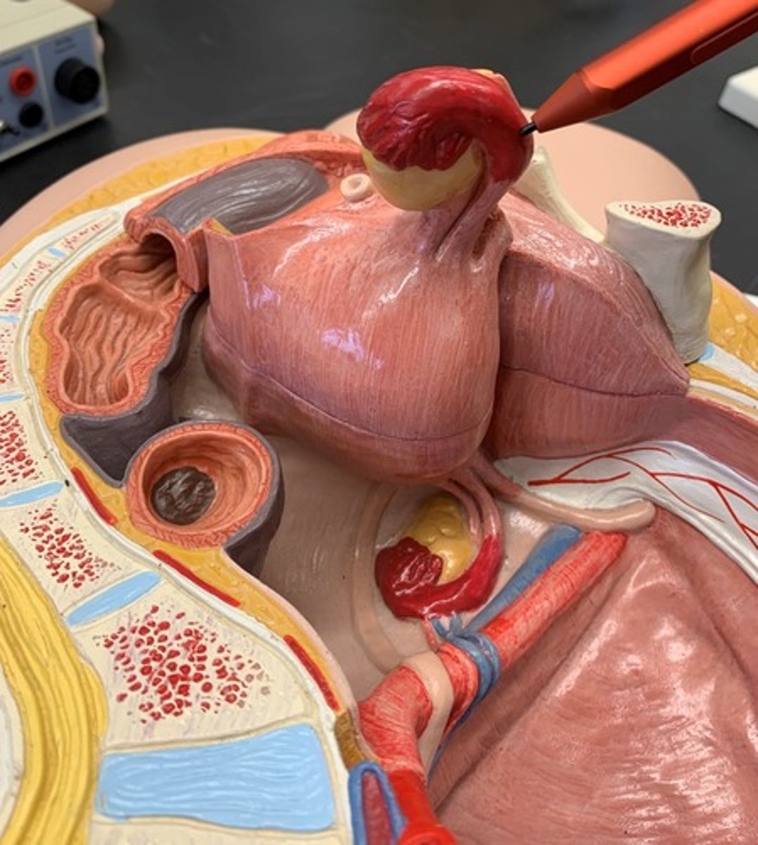 <p>bend in uterine tube</p>