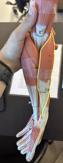 <p>What muscle is the yellow line indicating?</p>