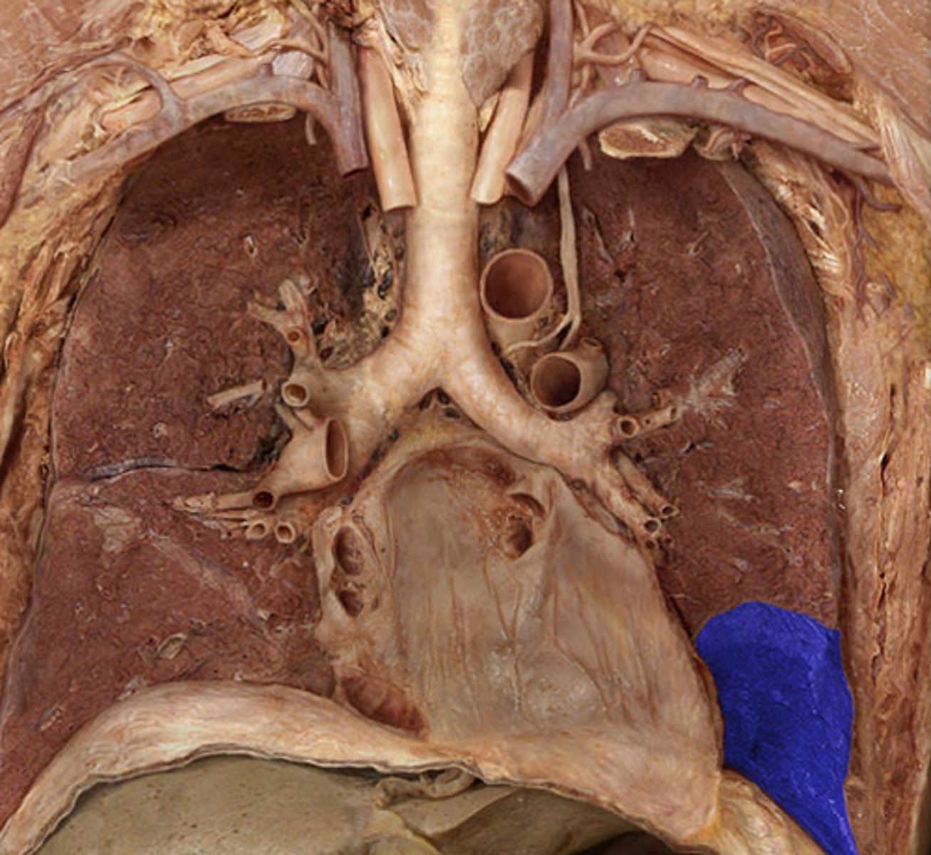 <p>Label the Lung Segment</p>