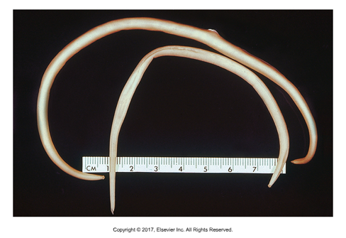 <ul><li><p>Found: Worldwide​</p></li><li><p>Small intestine of horse, mainly foals​</p></li><li><p>Cause of infection: Ingestion of ova​</p></li><li><p>Larvae migrate to liver through hepatic portal vein, then travel to lungs, coughed up and swallowed​</p></li><li><p>Largest of equine nematodes, can grow to 50cm​</p></li><li><p>Adults have distinctive lips​</p></li><li><p>Light infections can be asymptomatic, heavy infections can cause unthriftiness, colic, potbelly, depression and cough</p></li></ul><p></p>