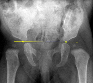 <p>Q what is the name of this measurement? and what is the average + range?</p>