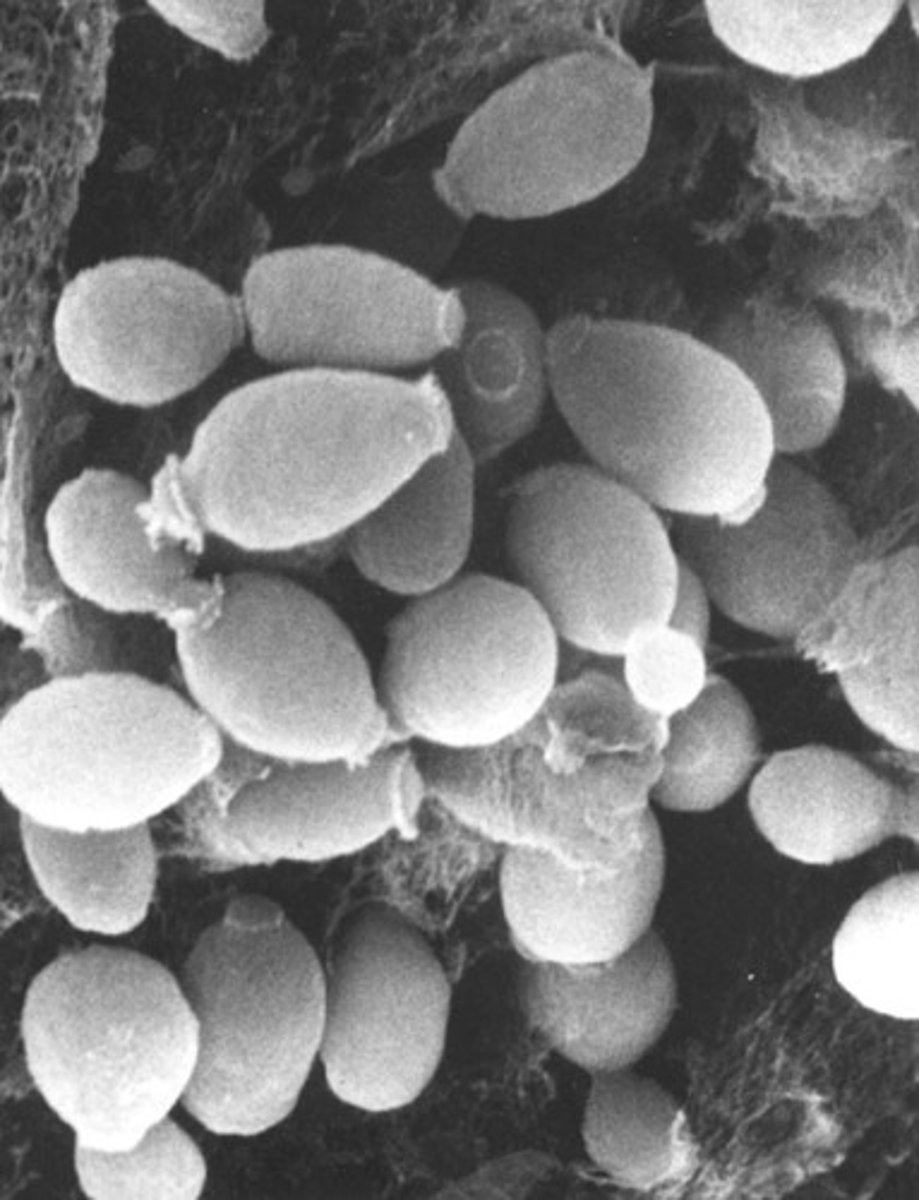 <p>product of anaerobic respiration in yeast cells</p>