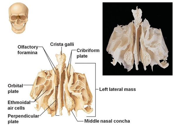 what bone is this?