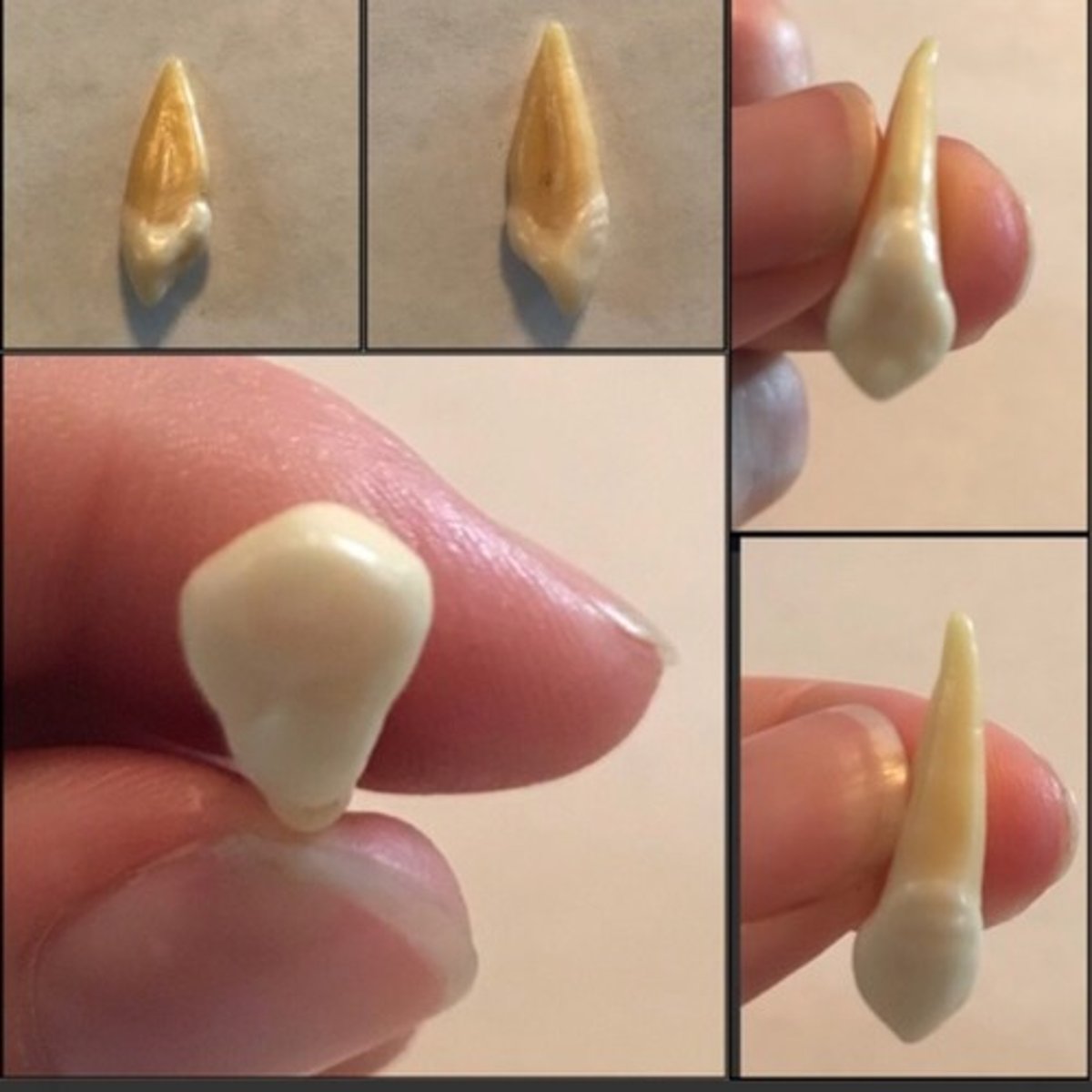 <p>What tooth is this ?</p>