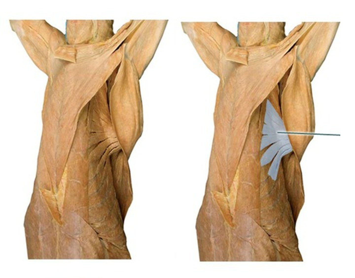 <p>What muscle is this?</p><p>Origin?</p><p>Insertion?</p><p>Function?</p><p>Innervation?</p>