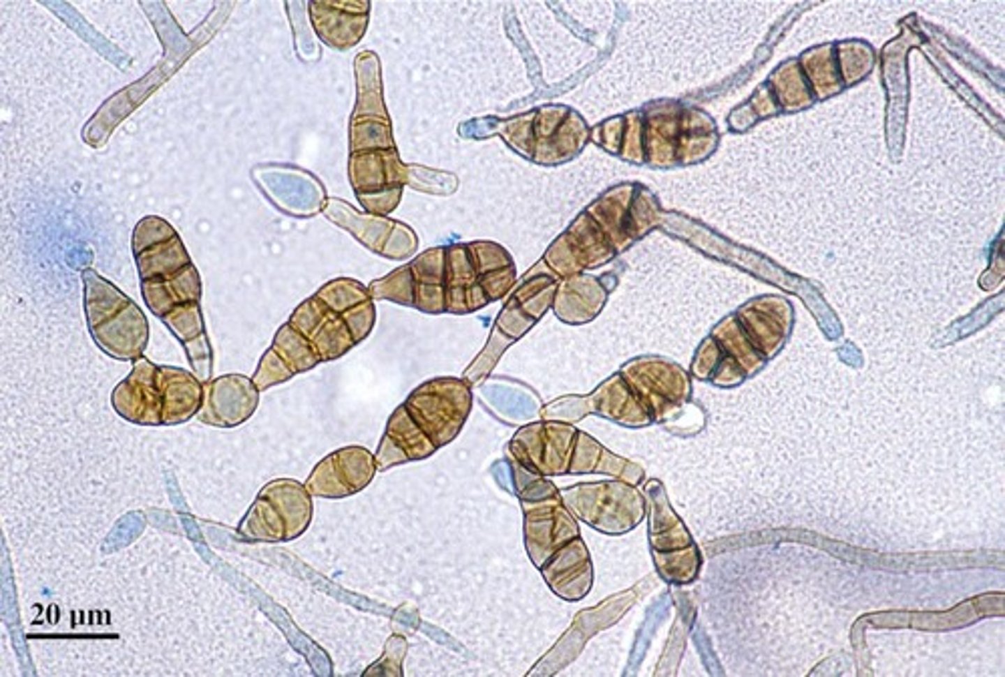 <p>CHAINED poroconidia HORIZONTAL and VERTICAL SEPTA</p><p>CLUB shaped bases</p>