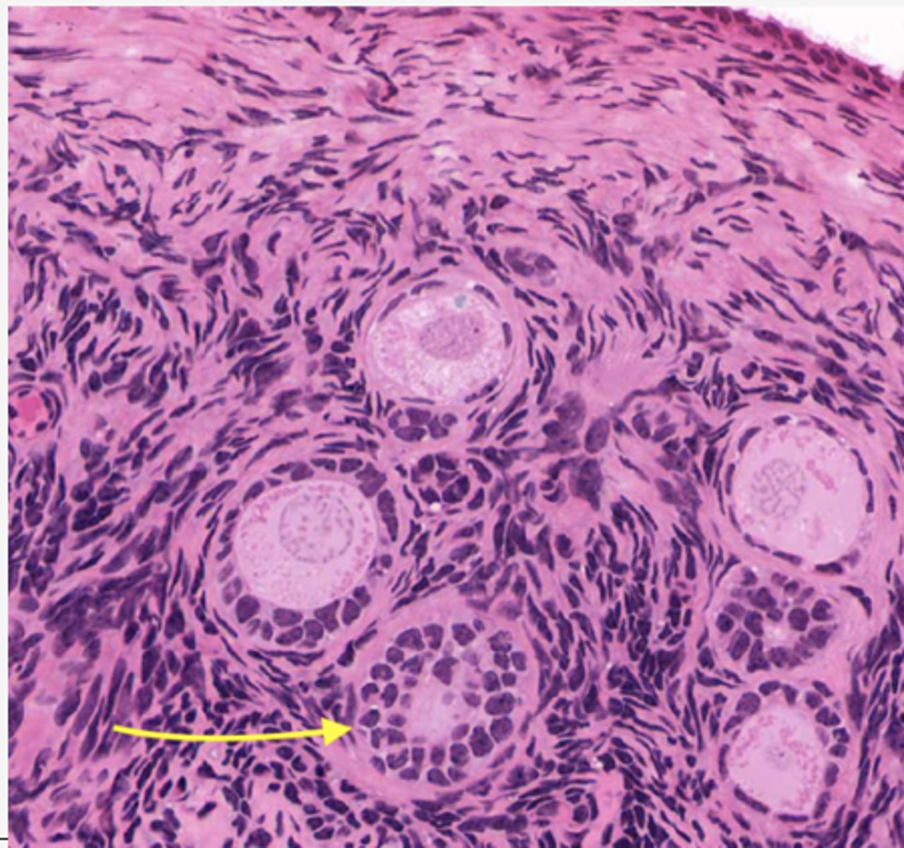 <p>Identify the stage of the follicle</p>