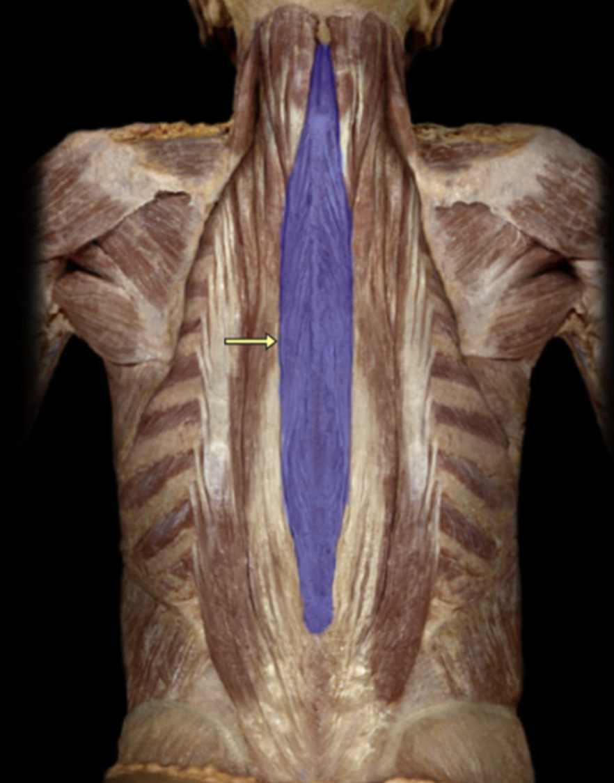 <p>spinalis M.</p>