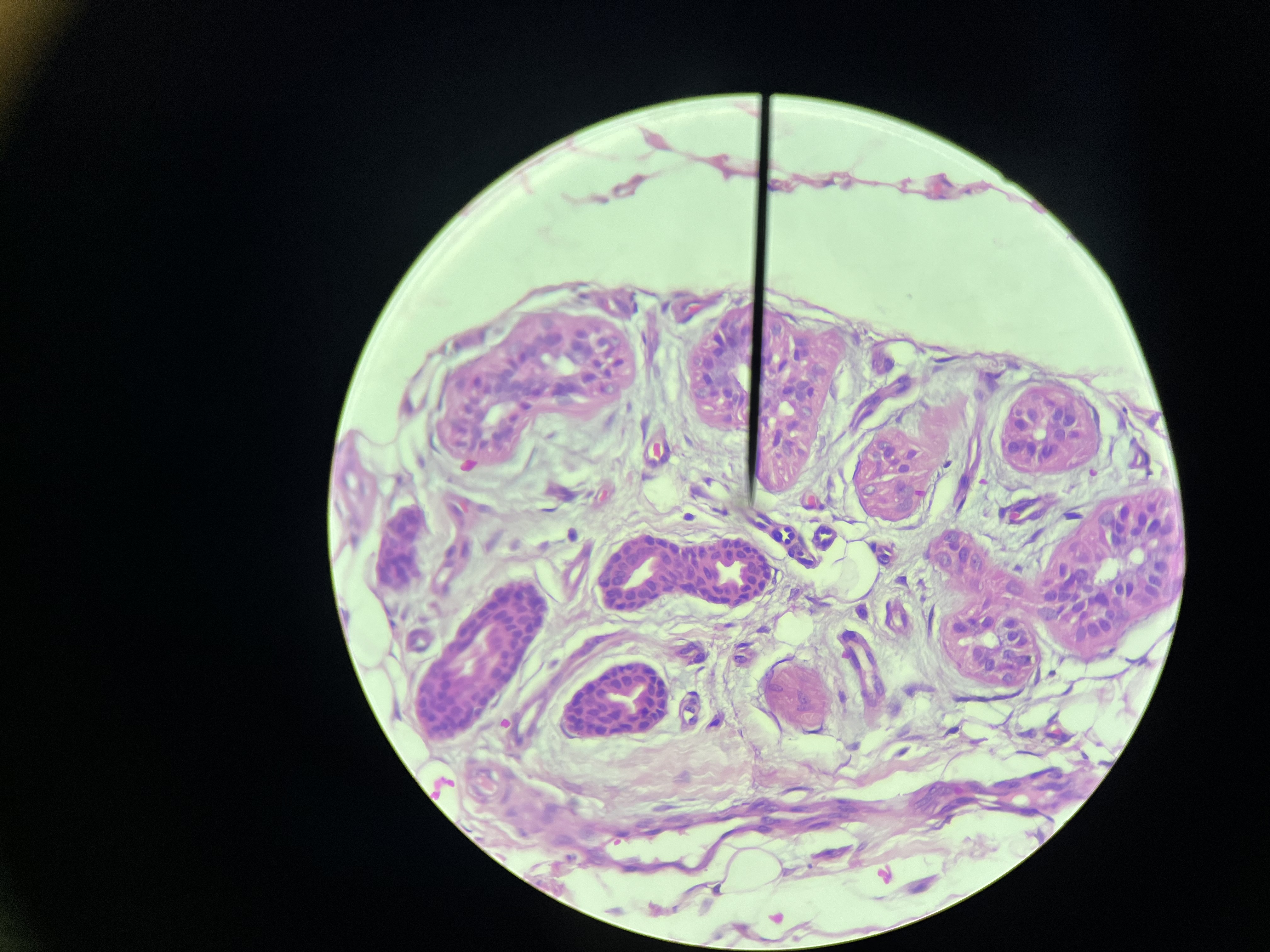 <p><span>The virus originates from the Poxviridae family, and its transmission can occur through skin-to-skin contact or by sharing personal items such as towels or clothing.</span></p>
