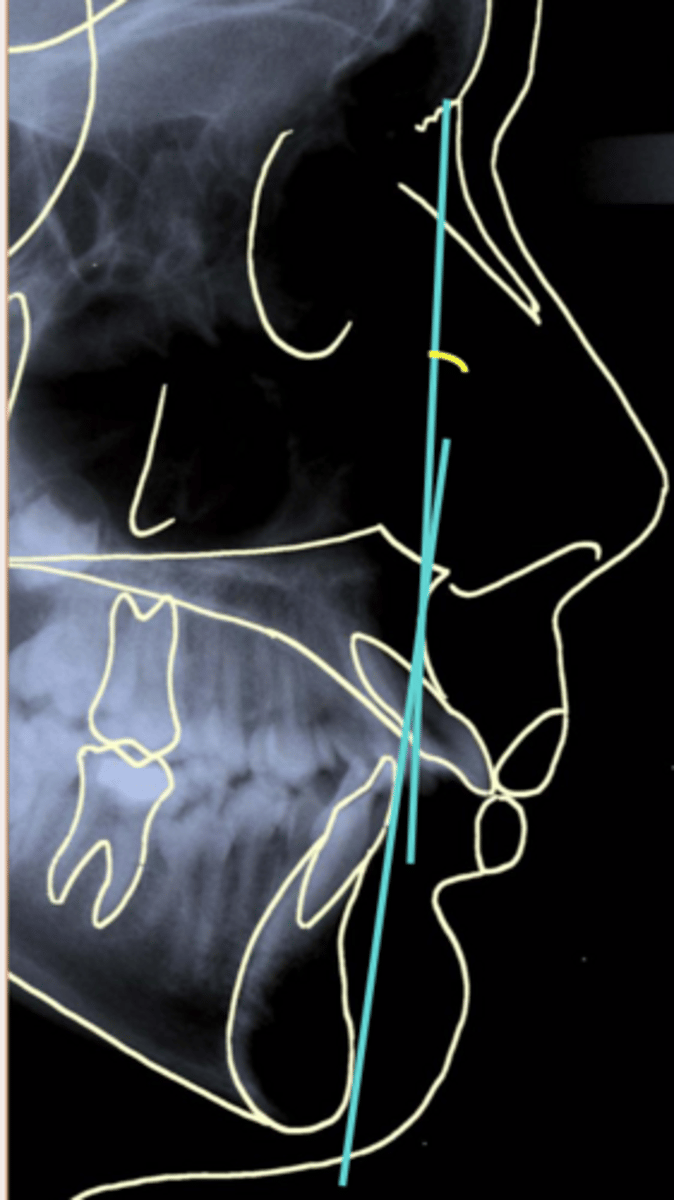 <p>ID the measurement being taken:</p>