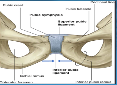 <p><span style="font-family: &quot;Bodoni MT&quot;">Each iliac crest, ASIS, PSIS and superior aspect of pubic symphysis tilt outward in a frontal/coronal plane on an anterior-posterior axis away from one another.</span></p><p></p><p><span style="font-family: &quot;Bodoni MT&quot;">Simultaneously each inferior aspect of the pubic symphysis moves toward each other.</span><span>&nbsp;</span></p>