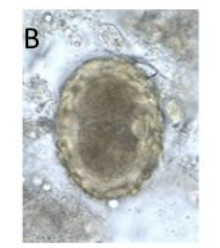 <p>What parasite does this egg belong to?</p>