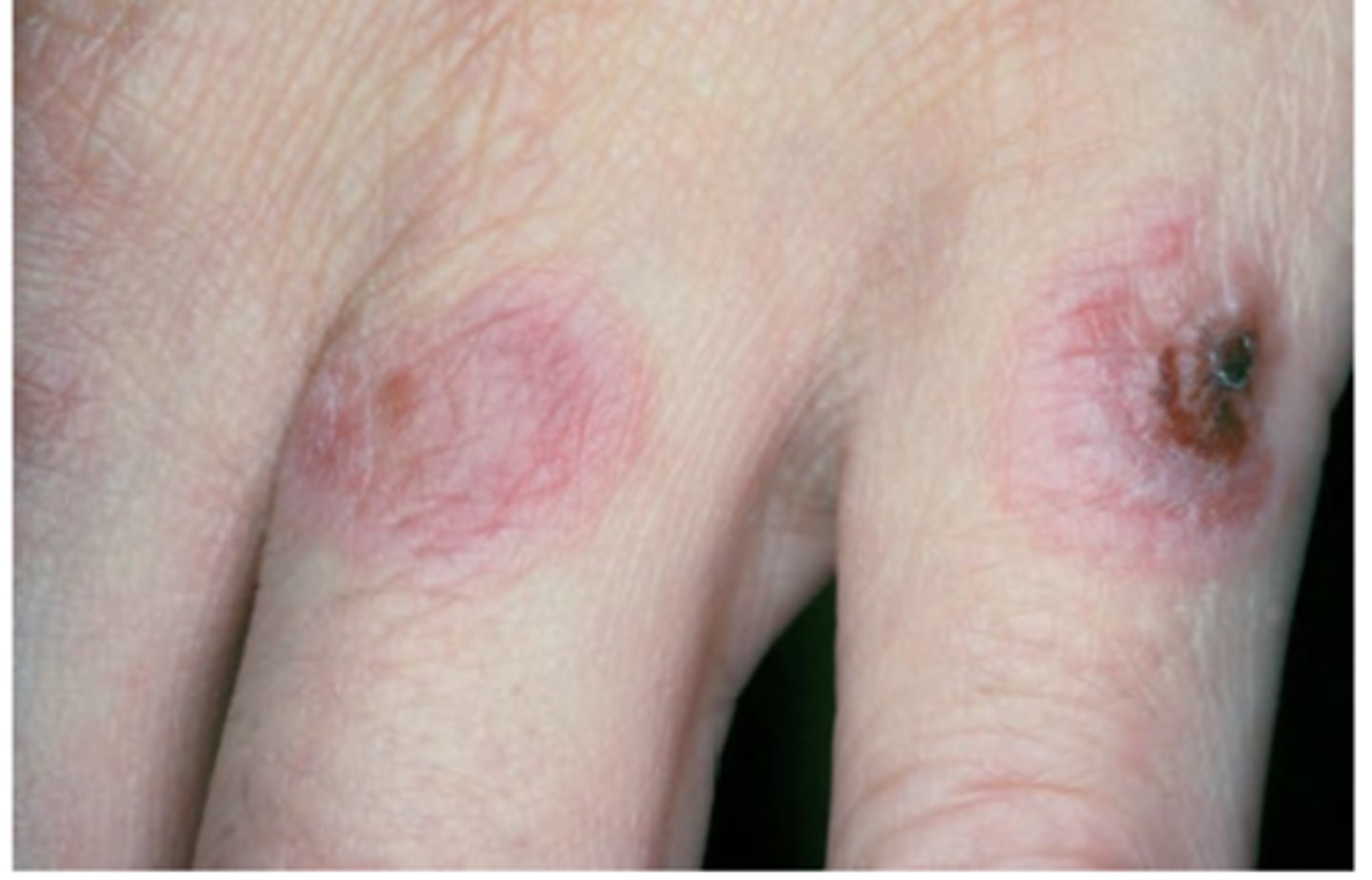 <p>Hint: target lesions</p>