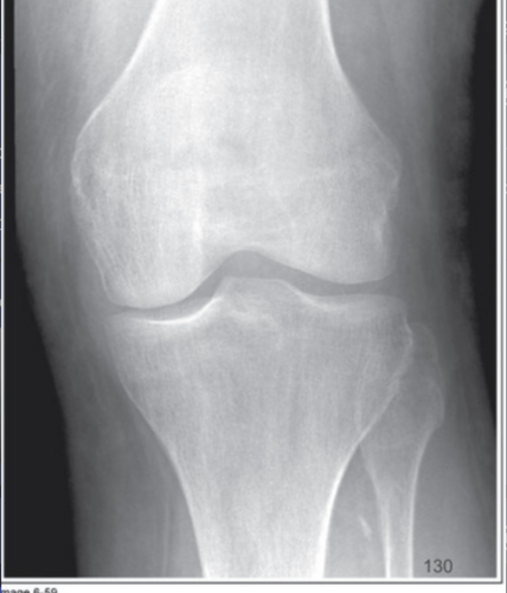 <p>Too much caudal angle</p>