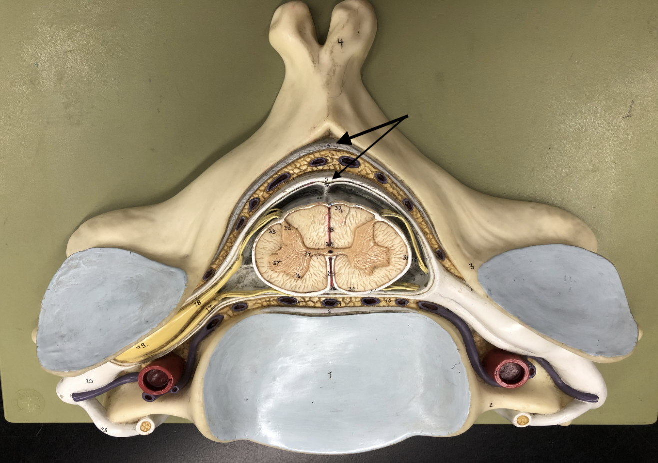 <p>what is this part of the vertebrae (of the spinal cord?)</p>