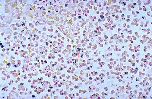 <ol><li><p>Describe pointed engulfed cells</p></li><li><p>What are some of the opsonins facilitating the attachment of PMN Neutrophils?</p></li></ol><p>Review: What does elevated procalcitonin levels indicate?</p>