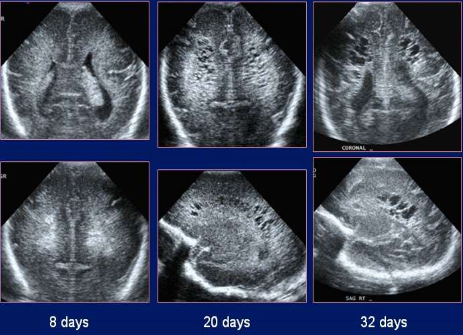 <p>What pathology is being shown?</p>