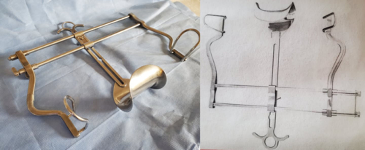 <p>Retracting abdominal wall to provide access to the peritneal cavity</p>