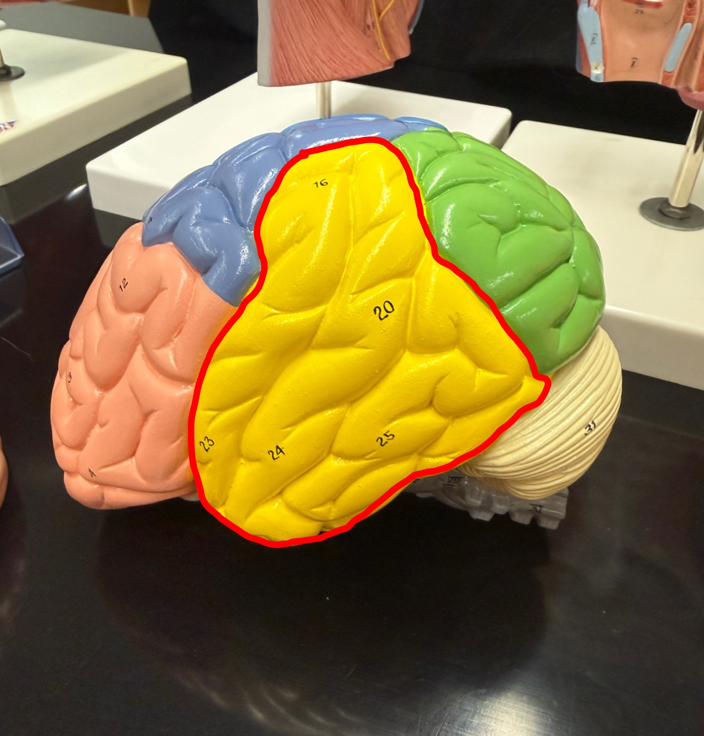 <p>What part of the brain is outlined in red? </p>