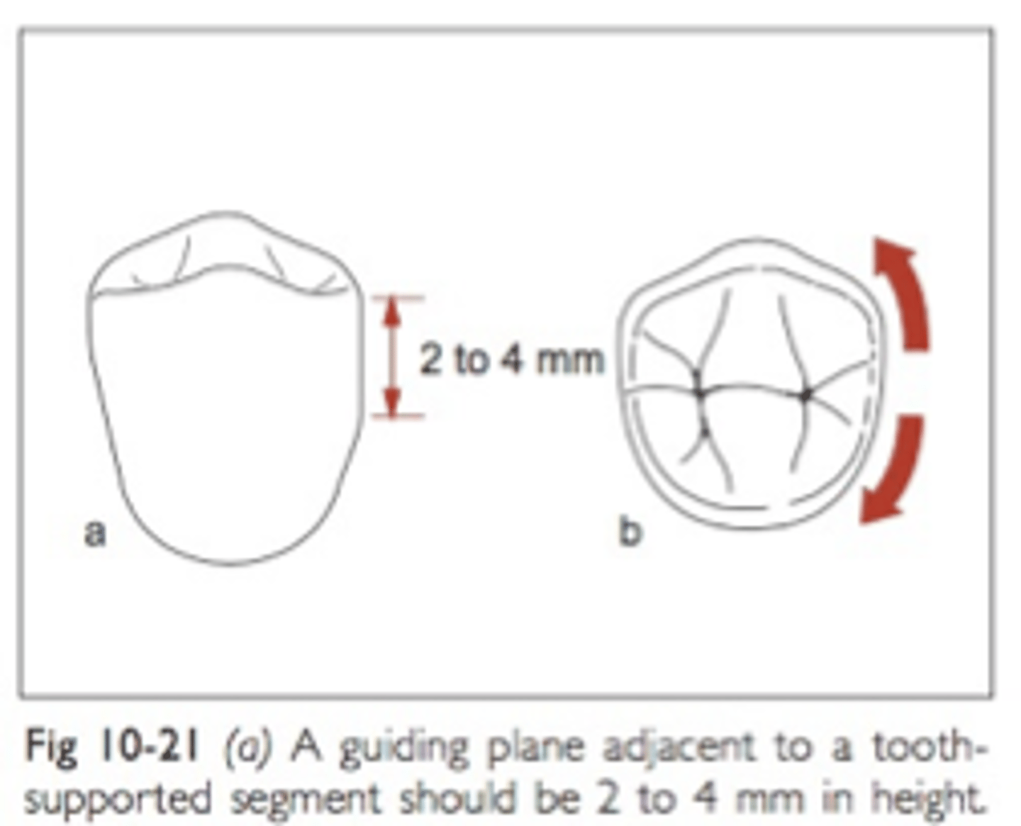 <p>Whether adjacent to tooth-borne or extension base segments, the prepared surface for RPD should not be a straight “slice” buccolingually, but should follow the ....</p>