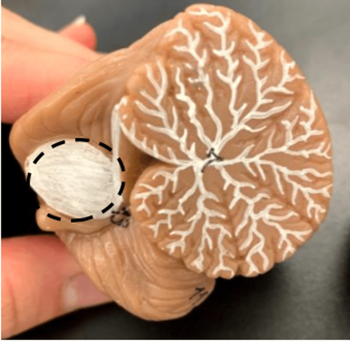 <p>cerebellum view</p>