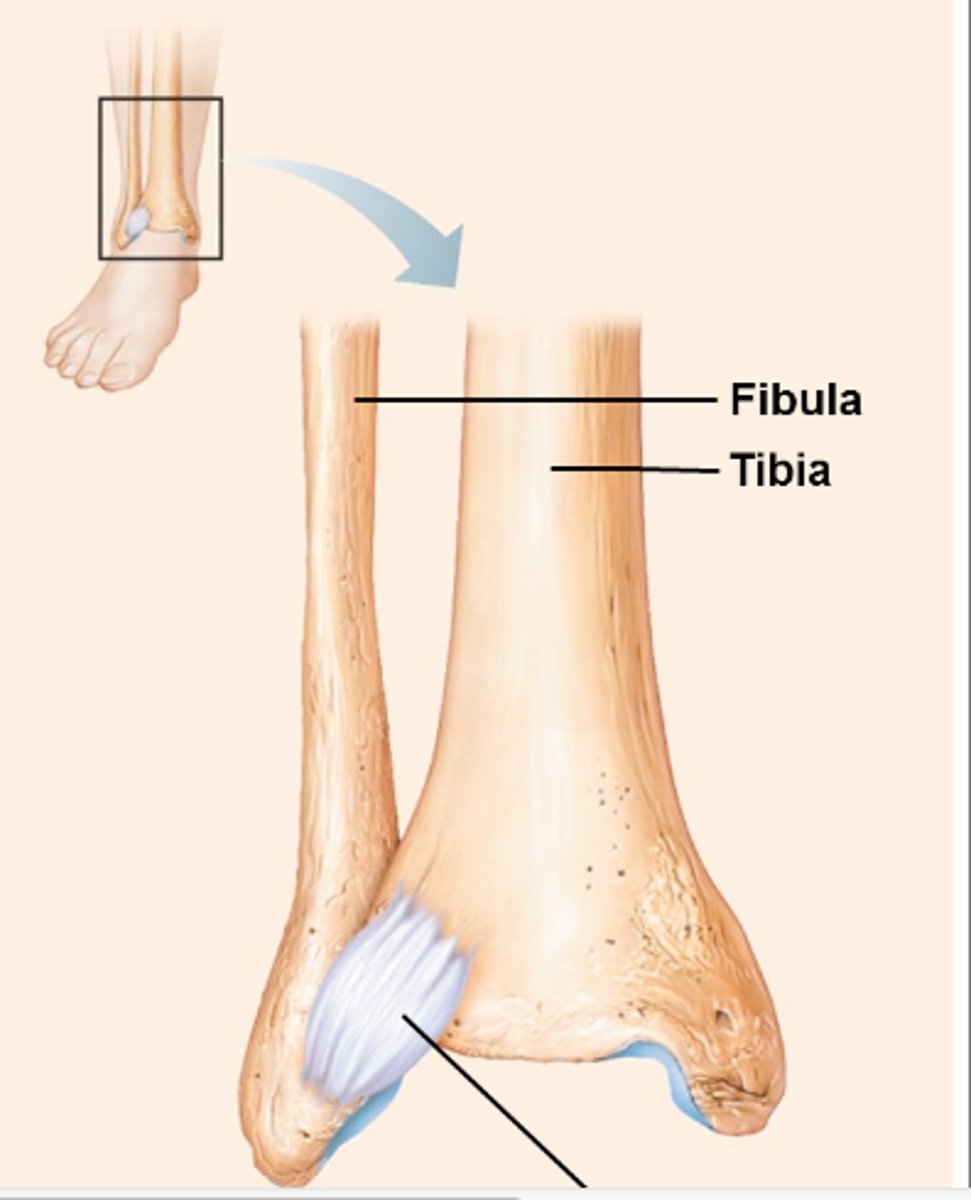 <p>Bones connected by ligaments (bands of fibrous tissue)</p><p>Movement varies from immovable to slightly movable</p>