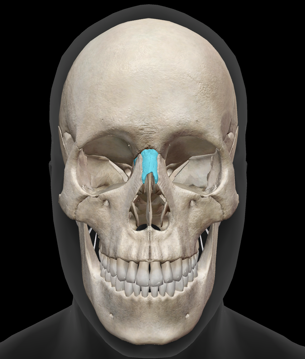 <p>What bone is this?</p>