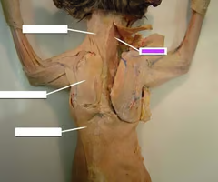 <p>What is the muscle indicated by the purple color? What is an attachment point and function?</p>