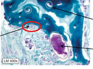 <p>Derived from mesenchymal stem cells and deposit bone matrix</p>