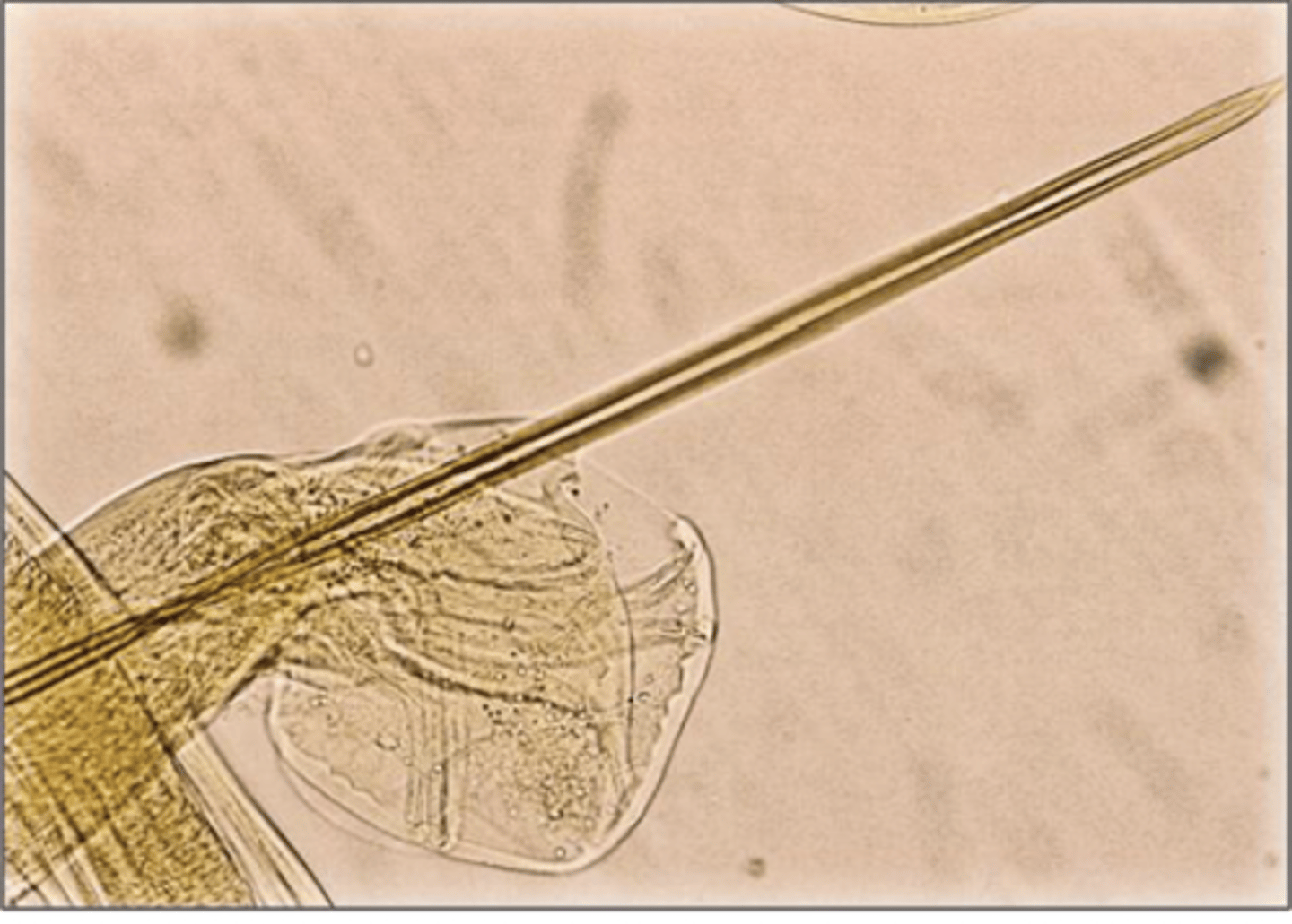 <p>What is this parasite? What characteristic/s did you use to identify it?</p>