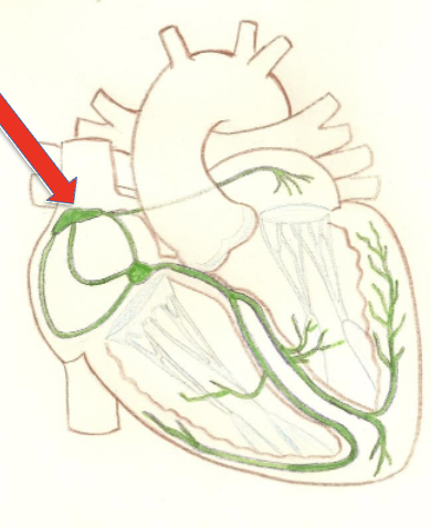 Located in the right atrial wall, sets the rhythm of the heart at roughly 75 times per minute, known as the heart's pacemaker.