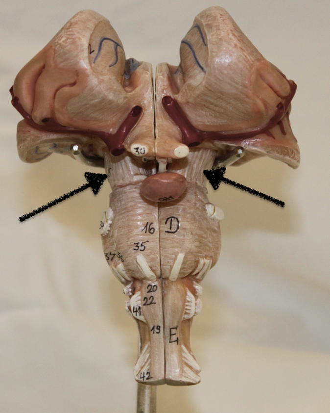 <p>identify this part of the brain</p>