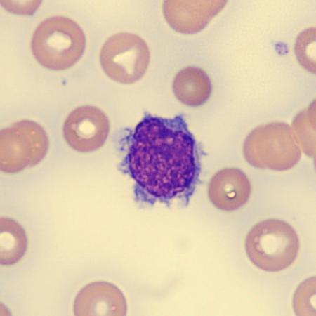 <p>What is this leukocyte?</p>