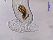 <p><span style="font-family: Calibri, sans-serif;"><strong><span>Trichostrongylus</span></strong></span></p><p><span style="font-family: Calibri, sans-serif;"><strong><span>Black Scour</span></strong></span></p><p><span style="font-family: Calibri, sans-serif;"><strong><span>SI, Abomasum</span></strong></span></p><p>Ruminants, horses, pig</p>